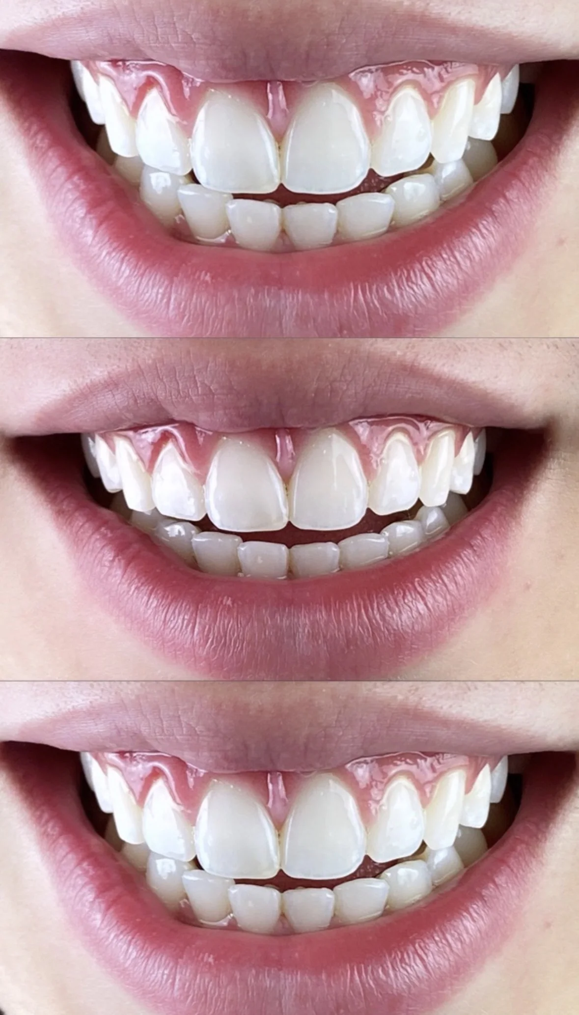 Registro clínico de tratamento estético odontológico